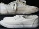 Sararan Beyaz Ayakkabı Plastik Yerleri Nasıl Temizlenir, Beyazlatılır