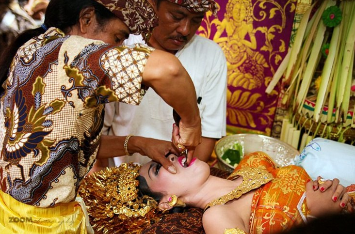 Bali'de dişi doldurma ritüeli