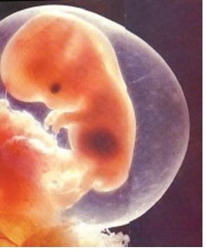 8 haftalik insan fetusu - Şekil 3