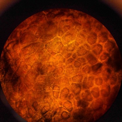 domatesin dış kabuğu mikroskopla inceleme