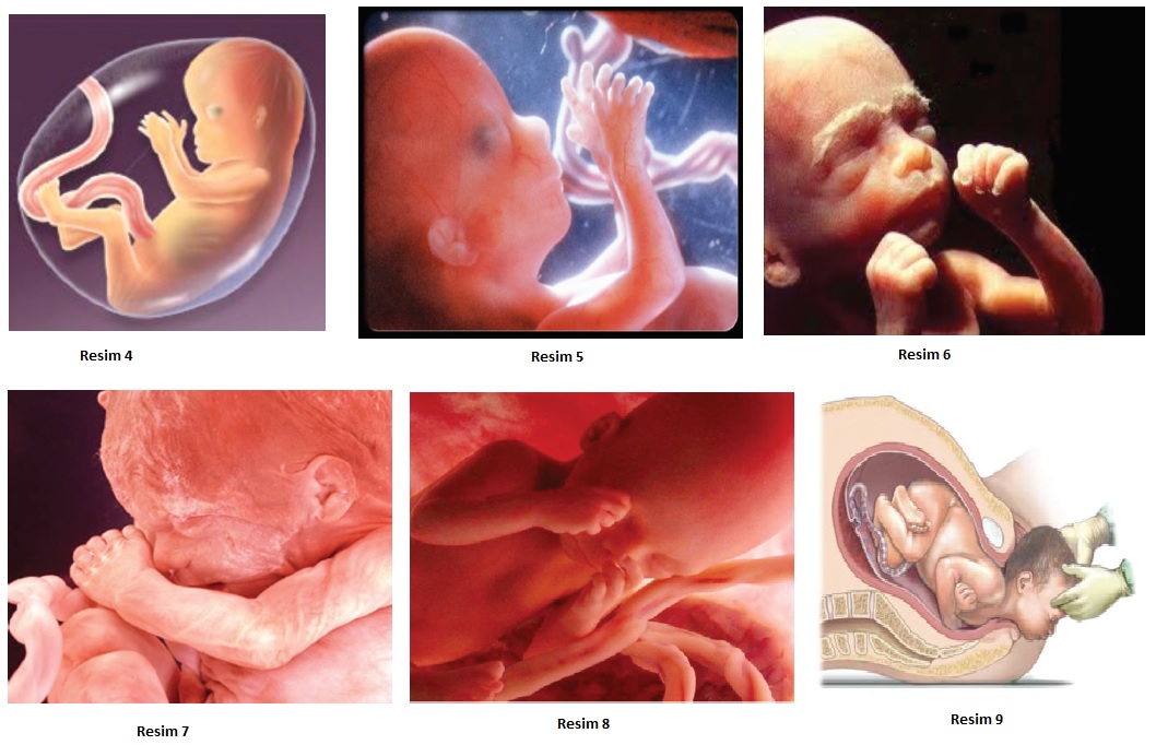 İnsan fetüsü gelişimi 
